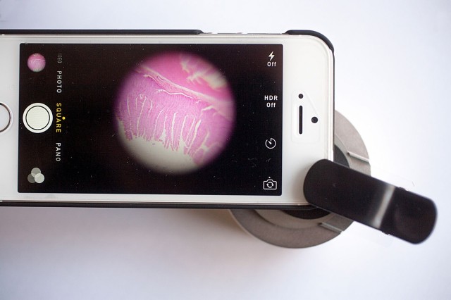 photo of This device turns your iPhone into a mobile microsope image