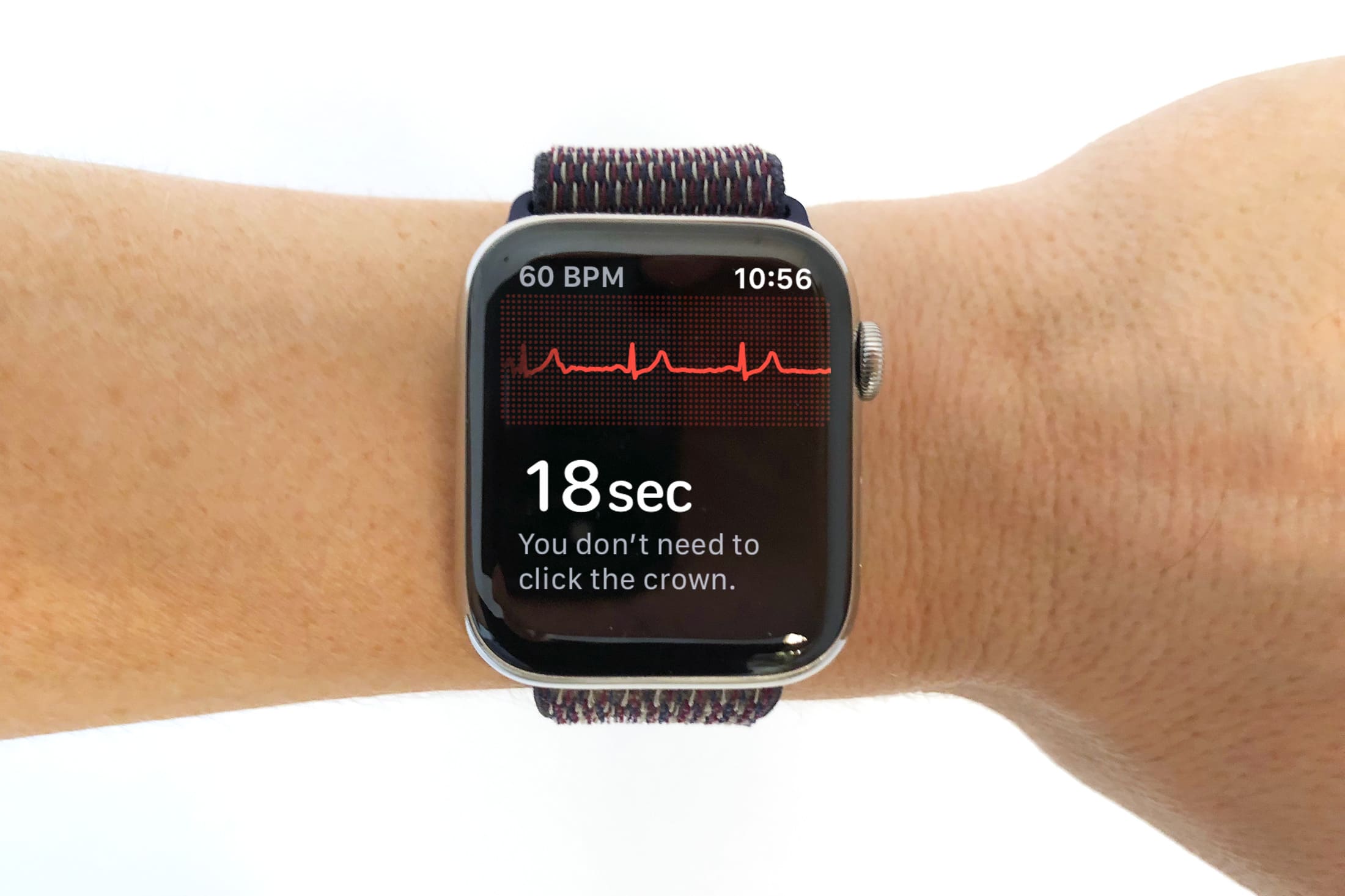apple watch resting heart rate